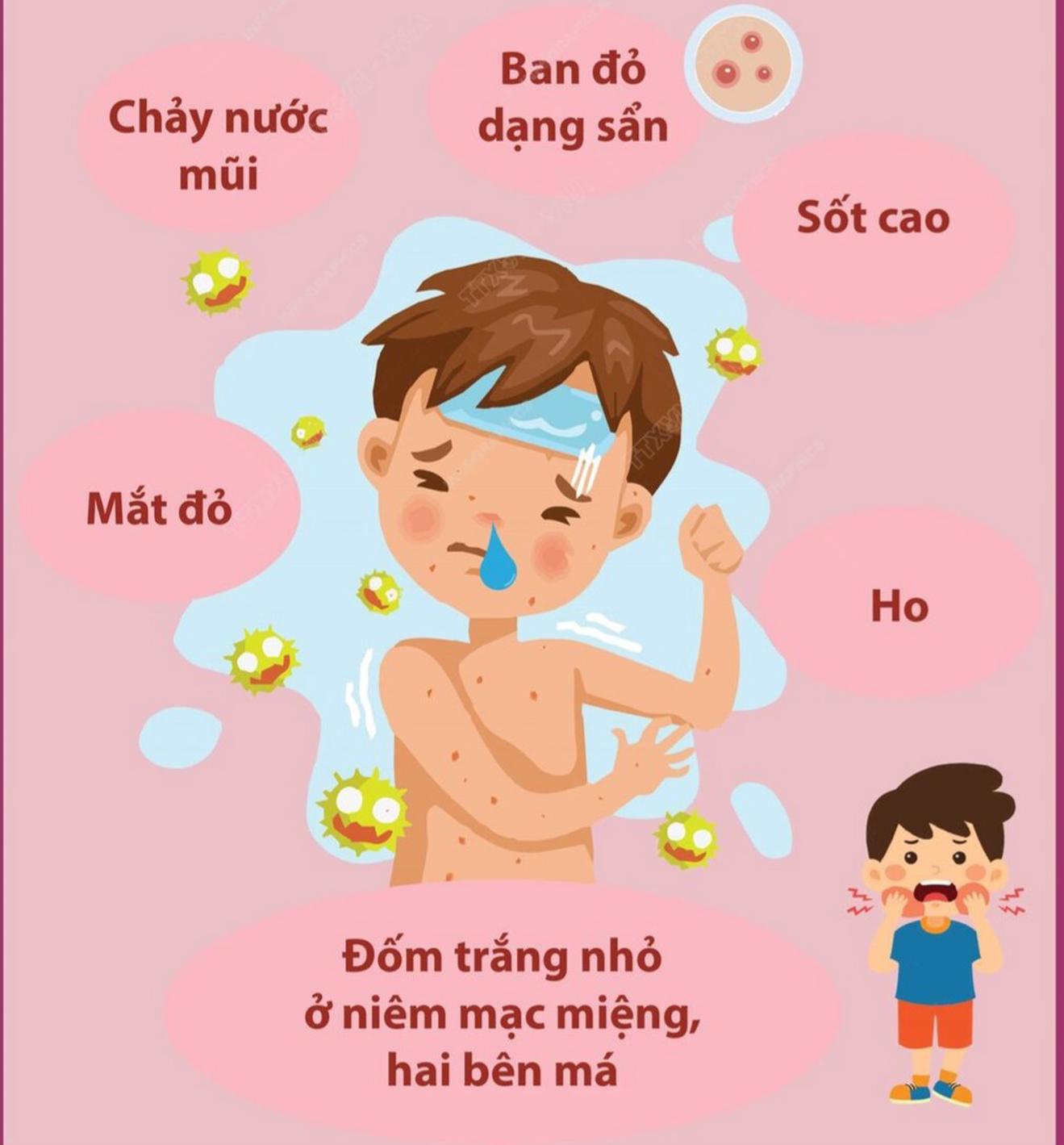 Công điện khẩn của Thủ tướng chống dịch sởi, đẩy nhanh tiêm chủng vaccine